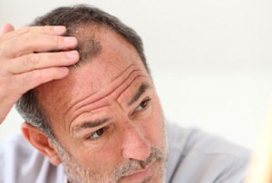 causes_of_hair_loss